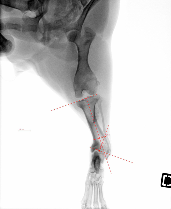 radiographie