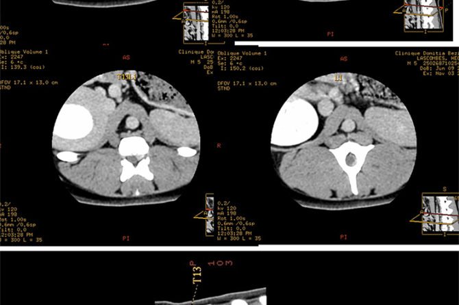 Neurochirurgie vétérinaire