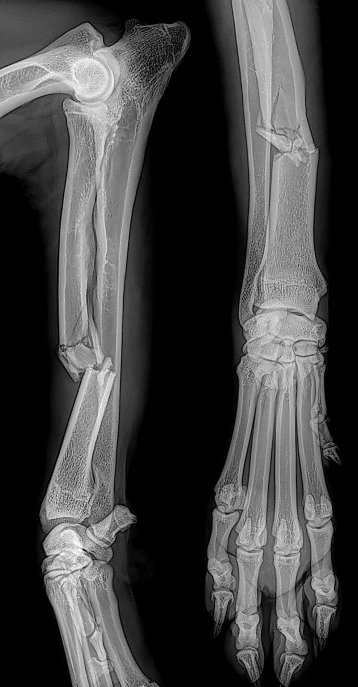 Cas Clinique Fracture Du Radius Orthovet Thierry Boulet Cas Clinique Fracture Du Radius Orthovet Thierry Boulet