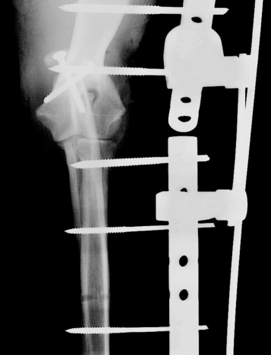 radiographie opération d'une rupture tendon du triceps chien - Clinique vétérinaire Orthovet
