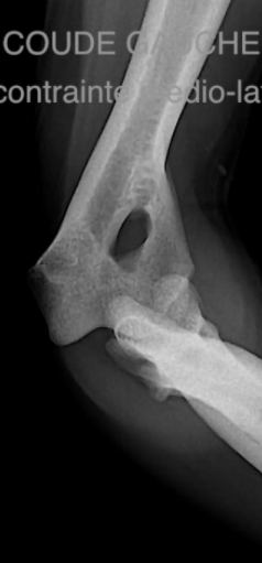 coude gauche problème rupture tendon chez le chien - clinique vétérinaire Orthovet