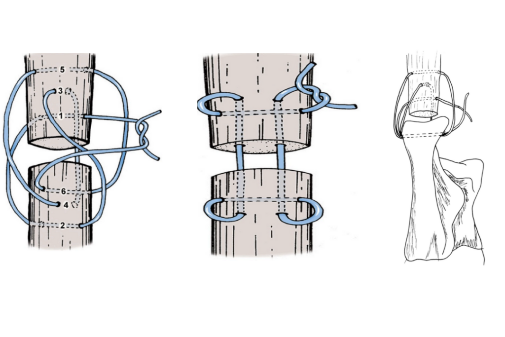 suture tendineuse en poulie à trois boucles - Orthovet, clinique vétérinaire St Jean de Védas