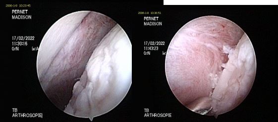 arthroscopie vétérinaire épaule