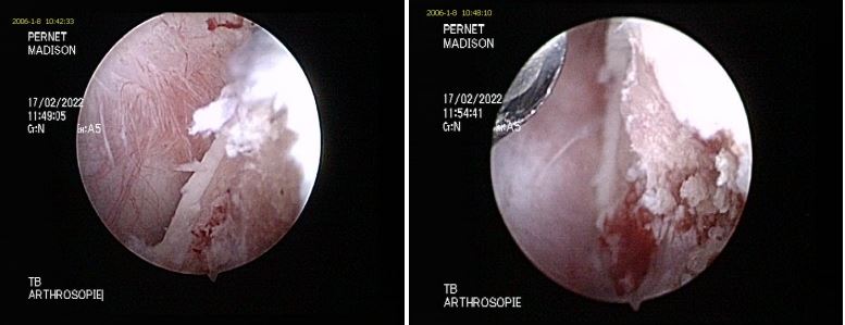 arthroscopie vétérinaire épaule