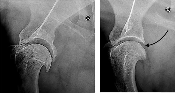 arthroscopie vétérinaire épaule