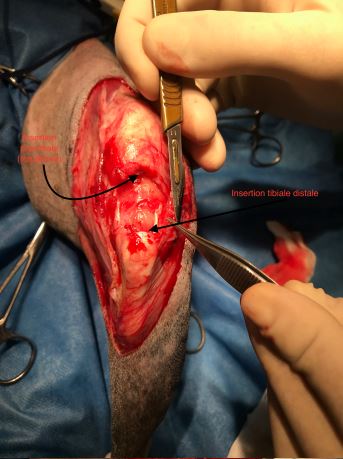 exploration chirurgicale rupture du ligament