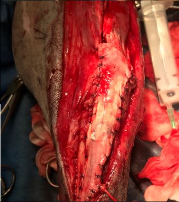 exploration chirurgicale rupture du ligament