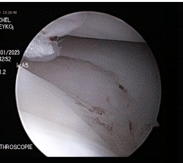 orthovet vue per opératoire