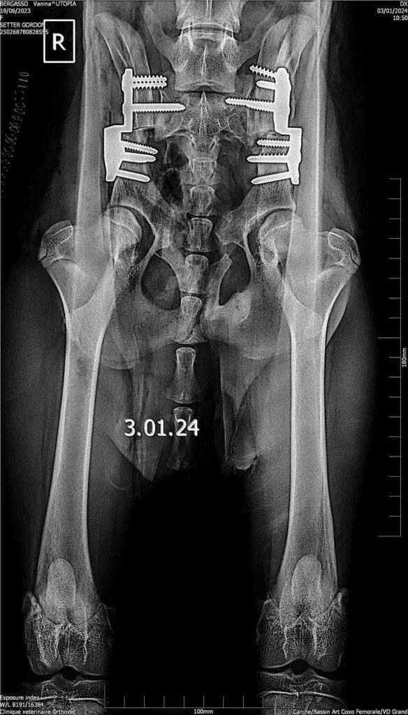 osteotomies-pelvienne