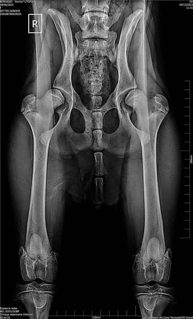 osteotomies-pelvienne